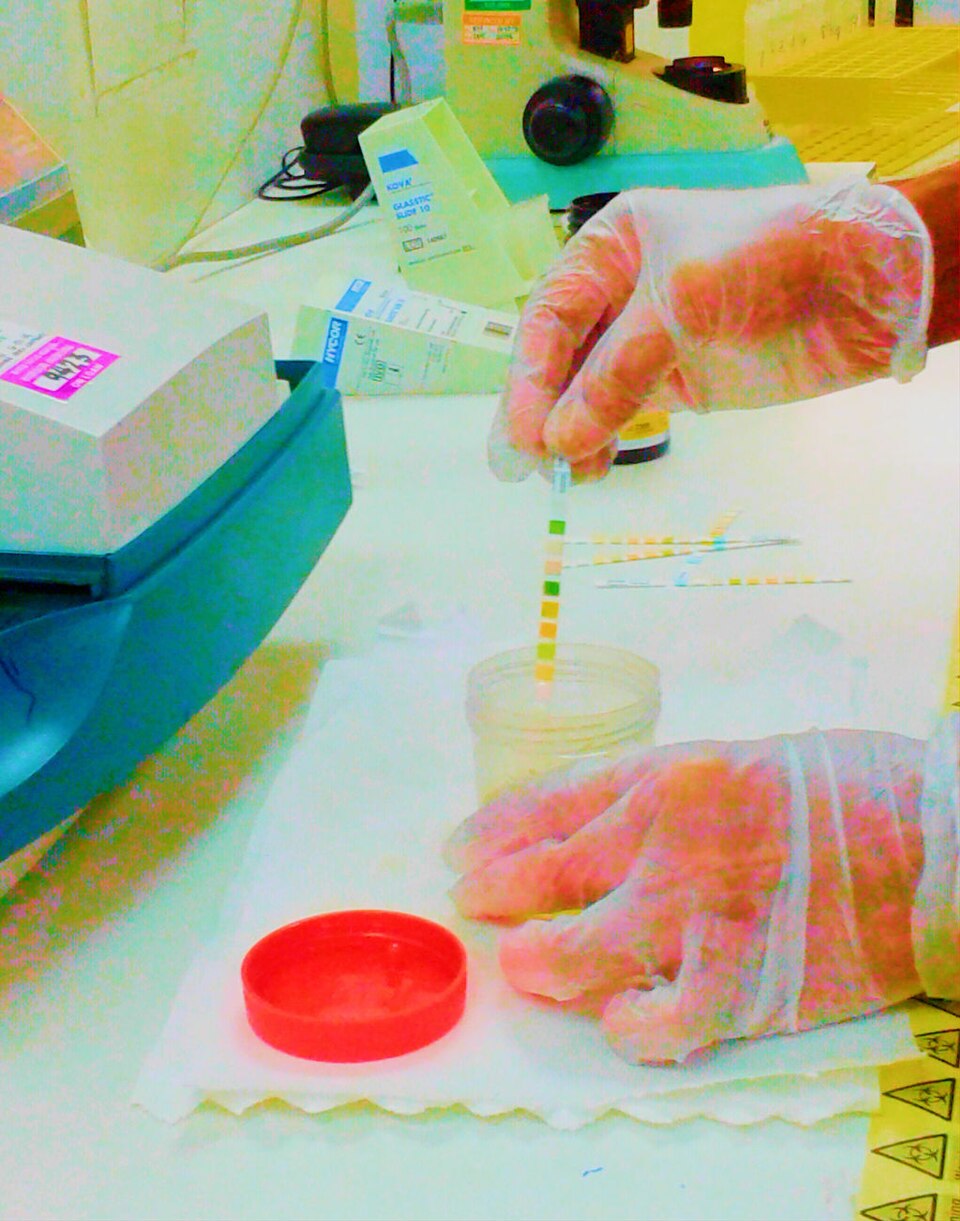 Urinalysis dipstick