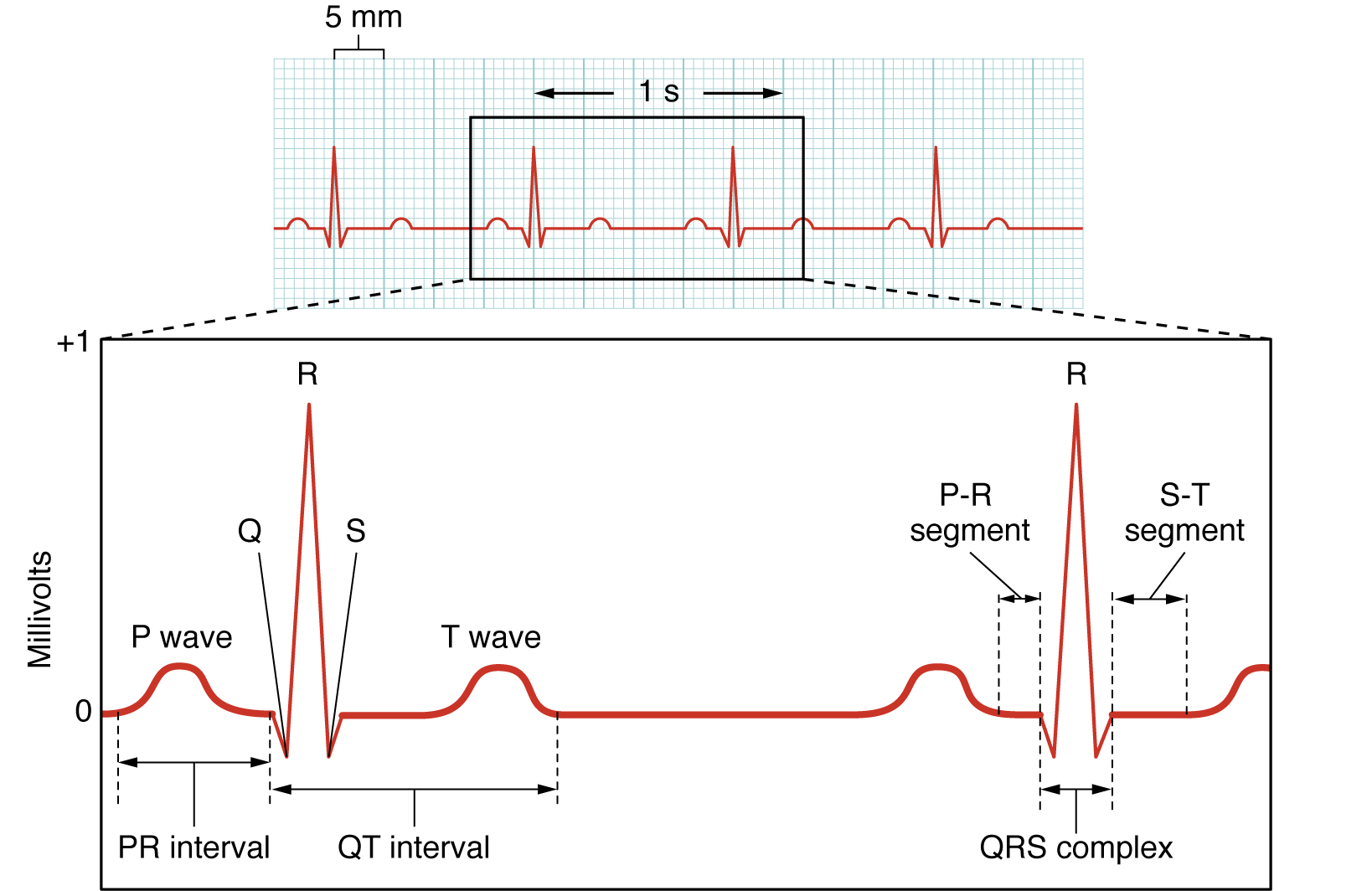 ECG waveform: P-QRS-T waves, intervals and segments