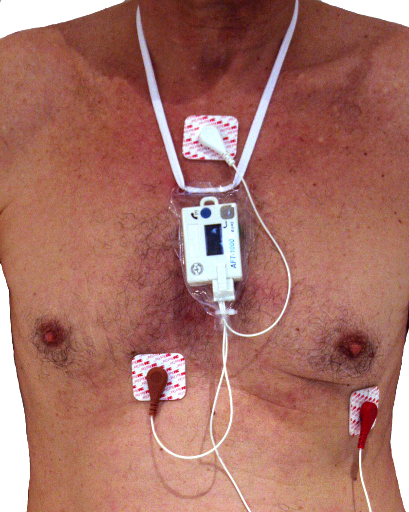 Holter monitor